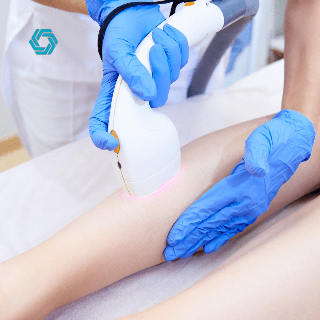 Now Is The Time To Invest In Laser Hair Removal