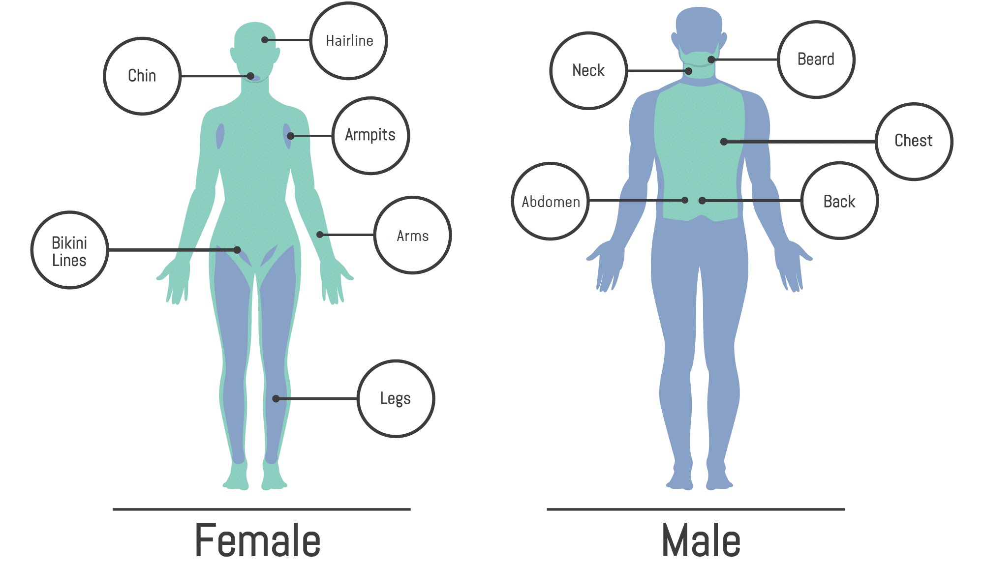 hair removal diagram WITH addition